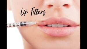 Lip Filler Frisco