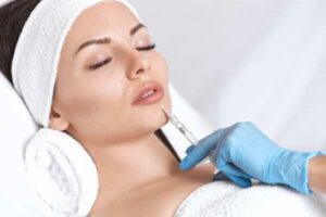 Lip filler