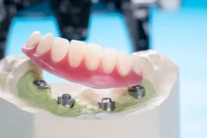 implant supported dentures panacea fl