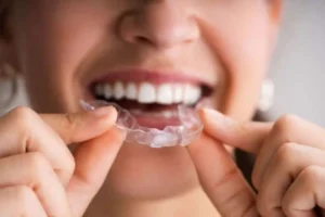 invisible braces thibodaux la