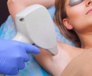 laset hair removal in Gurgaon