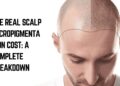 scalp micropigmentation cost