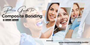 composite bonding in London at a cheap