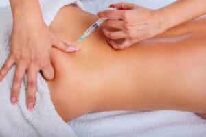 acupuncture services
