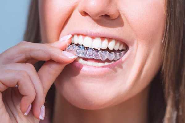 orthodontist Cardiff