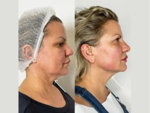 Best Doctors in Dubai for Anti-Aging and Aesthetic Care