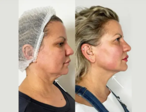 Best Plastic Surgeons in Dubai for Hollywood-Style Transformations