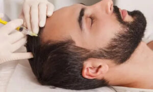PRP Hair Treatment in Islamabad