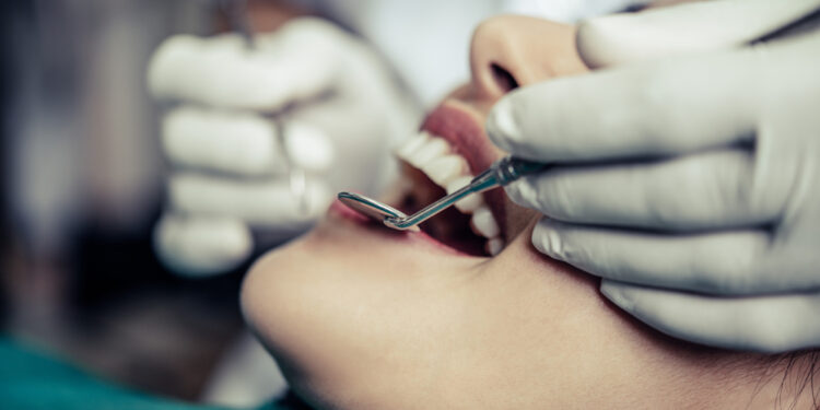 Tooth Extraction